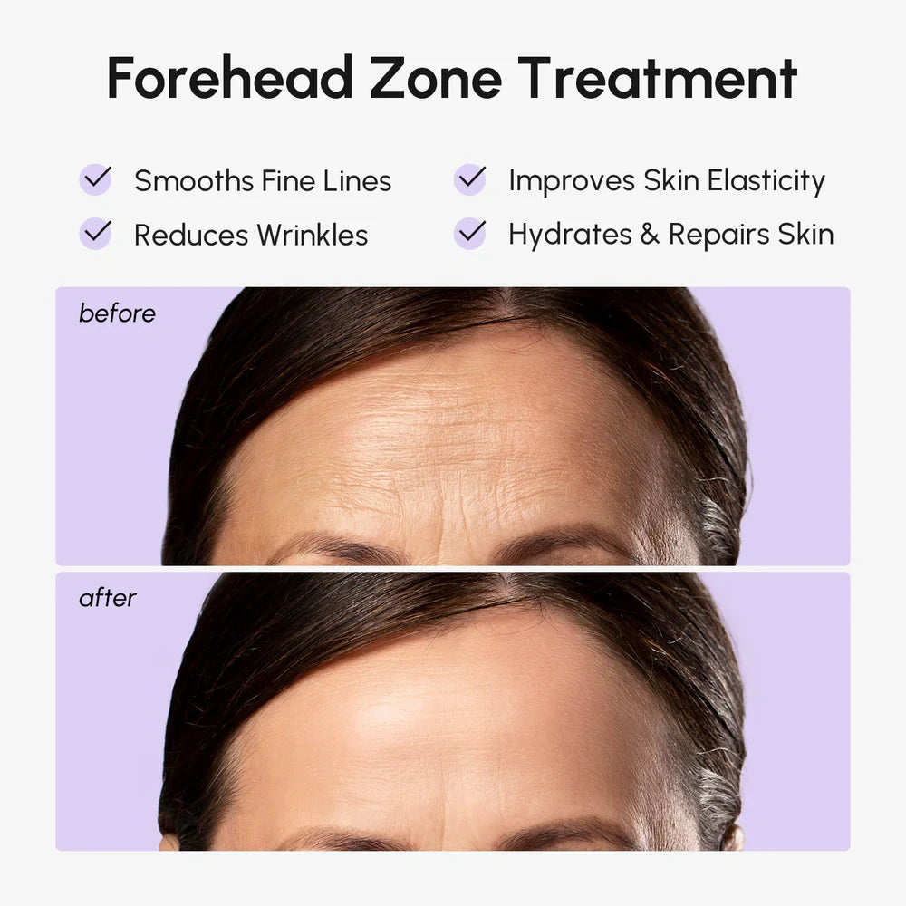 The Anti-Wrinkle Forehead Patch