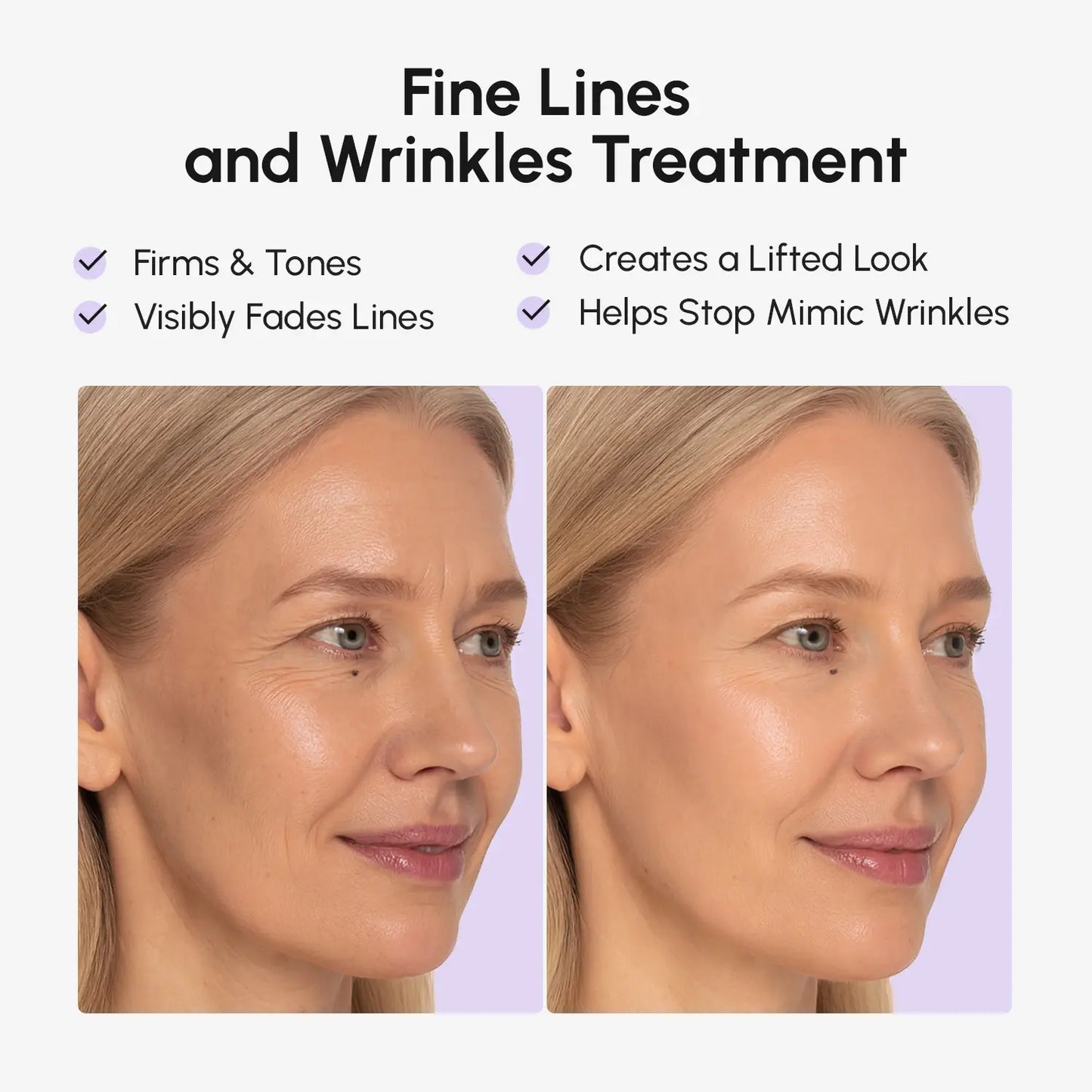 The Anti-wrinkle Tape Patch